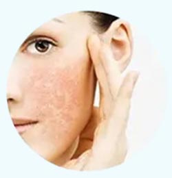 After-Sun Repair Liquid