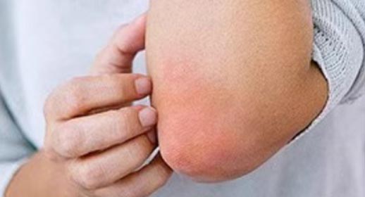 Hyaluronic Acid Anti-Allergy Essence