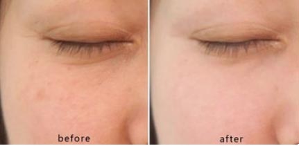 Soothing and Anti-Aging Care Liquid